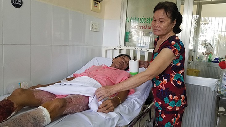 Hồi sinh nhờ… da của  người khác