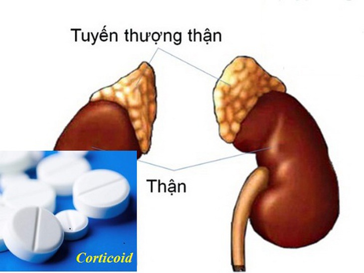 corticoid