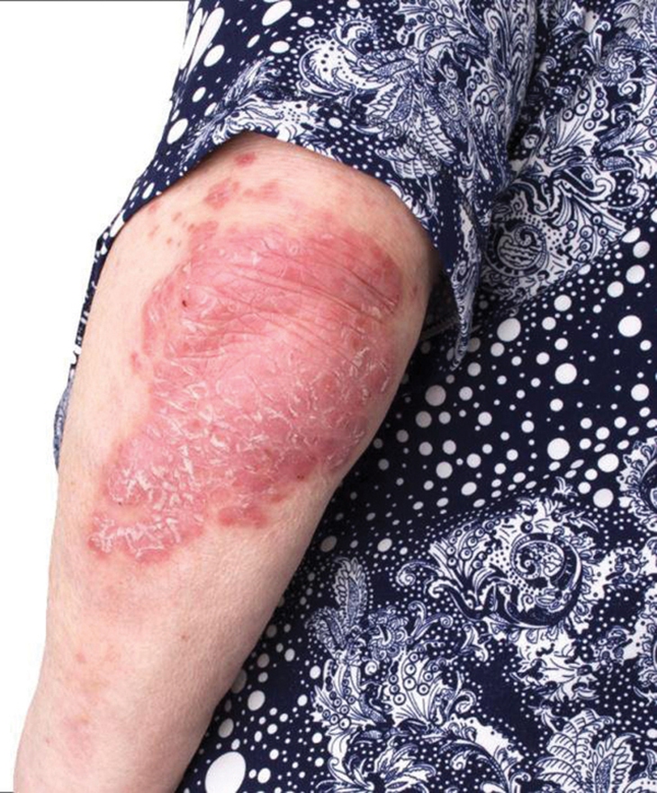 cơ xương khớp và da liễu