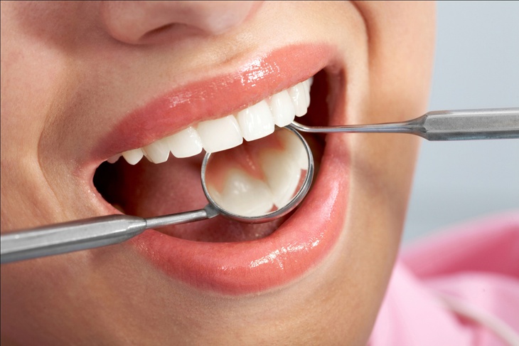 Cách hạn chế ê buốt răng