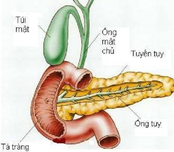 viêm tụy do rượu
