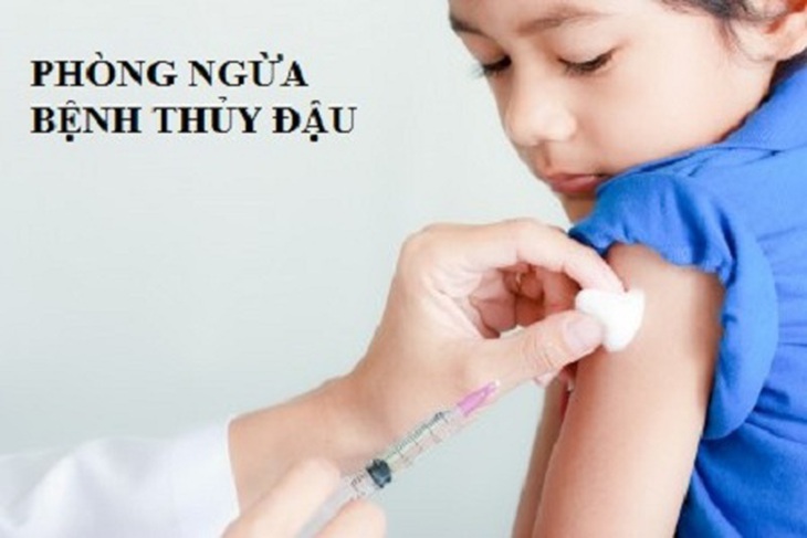tiêm phòng thủy đậu