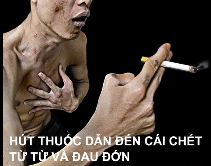  - Ảnh 1.