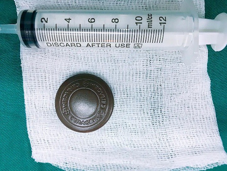 Ngậm đá nano chữa viêm họng lúc ngủ, cụ bà 'nuốt chửng' phải cấp cứu