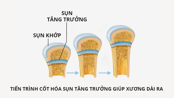 Hãy giúp con tăng chiều cao trước khi quá muộn