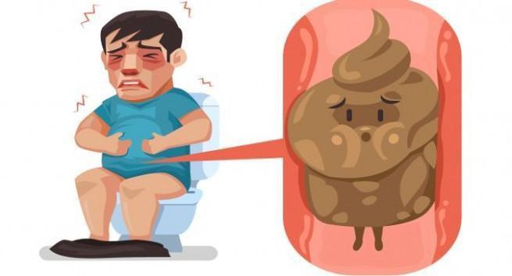 Đừng chủ quan khi bị táo bón