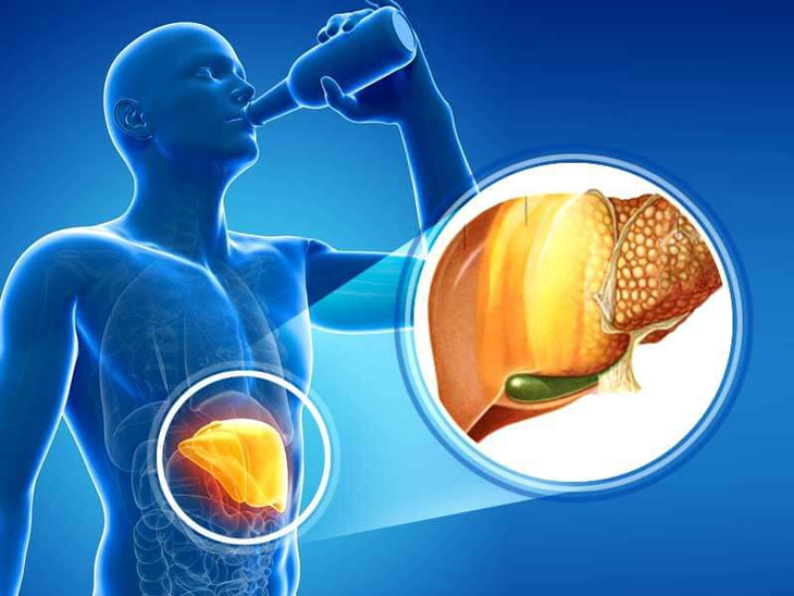 6 nhóm đồ ăn làm cho gan nhiễm mỡ nặng nề hơn