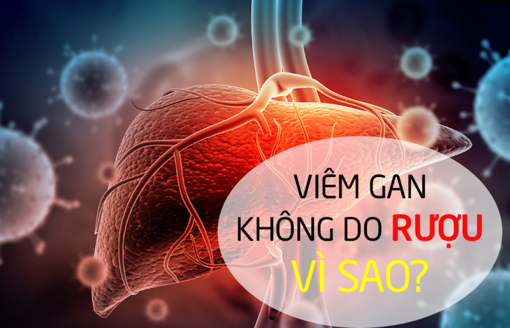 Viêm gan không do rượu: Nguyên nhân và biện pháp cải thiện