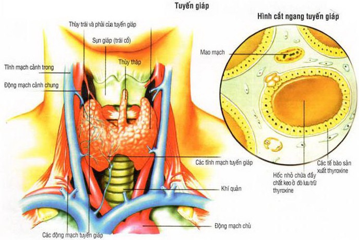 ung thư tuyến giáp