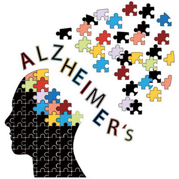  Alzheimer