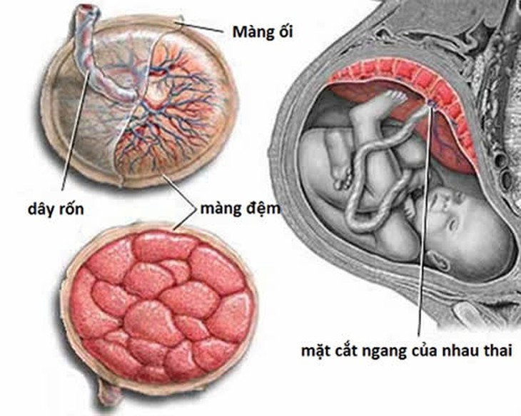 Nhau thai giúp chẩn đoán bệnh tật của thai nhi