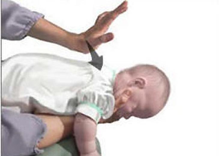 Trẻ hóc sặc dị vật - nguy hiểm đến tính mạng 1
