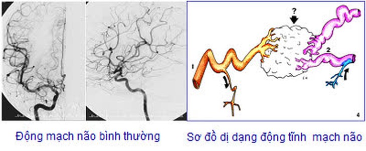 Kẻ thù câm lặng 1