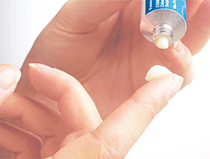 Không dùng tùy tiện kem thoa có chứa steroid 1
