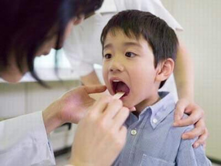 Viêm họng mùa hè ở trẻ nhỏ 1
