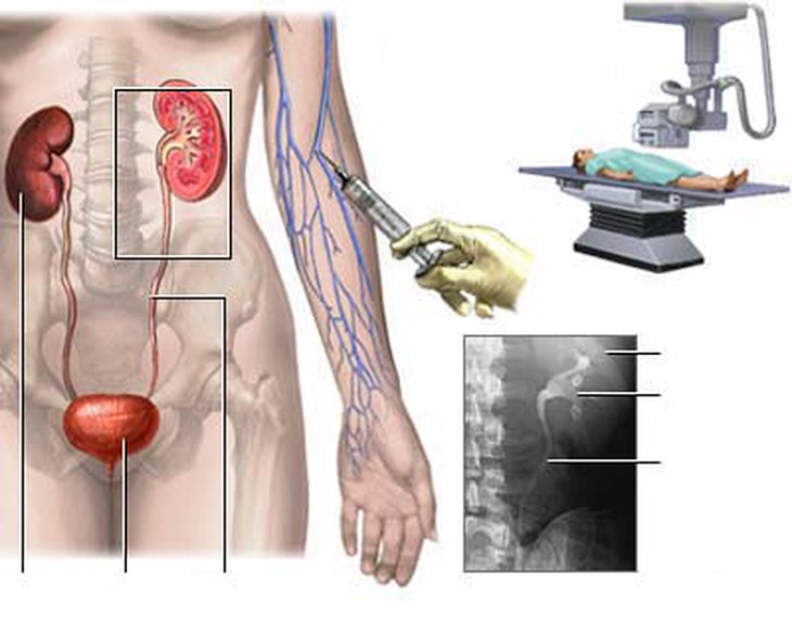 Ðái ra dưỡng chấp có nguy hiểm? 1