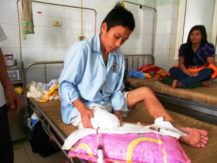 Cắt bỏ khối u hơn 10kg đeo trên chân 2