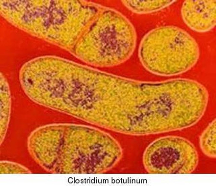 Tránh ngộ độc do vi khuẩn C. Botulinum, cách nào? 1