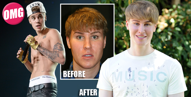 Chi 100.000 USD để có ngoại hình giống Justin Bieber 1