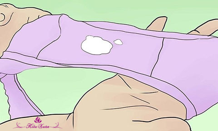 kinh nguyệt không đều và ra nhiều huyết trắng hay gặp ở phụ nữ