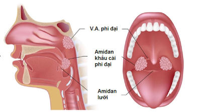 VA4