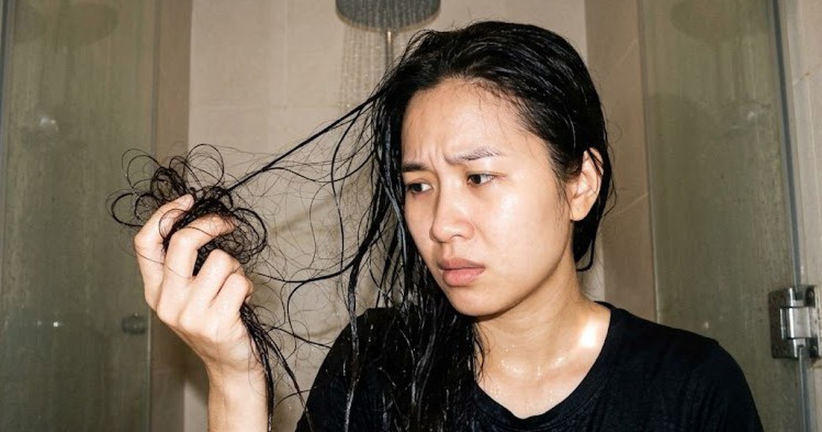 Rụng tóc bao nhiêu khi gội đầu là bình thường? 5 cách hạn chế rụng tóc