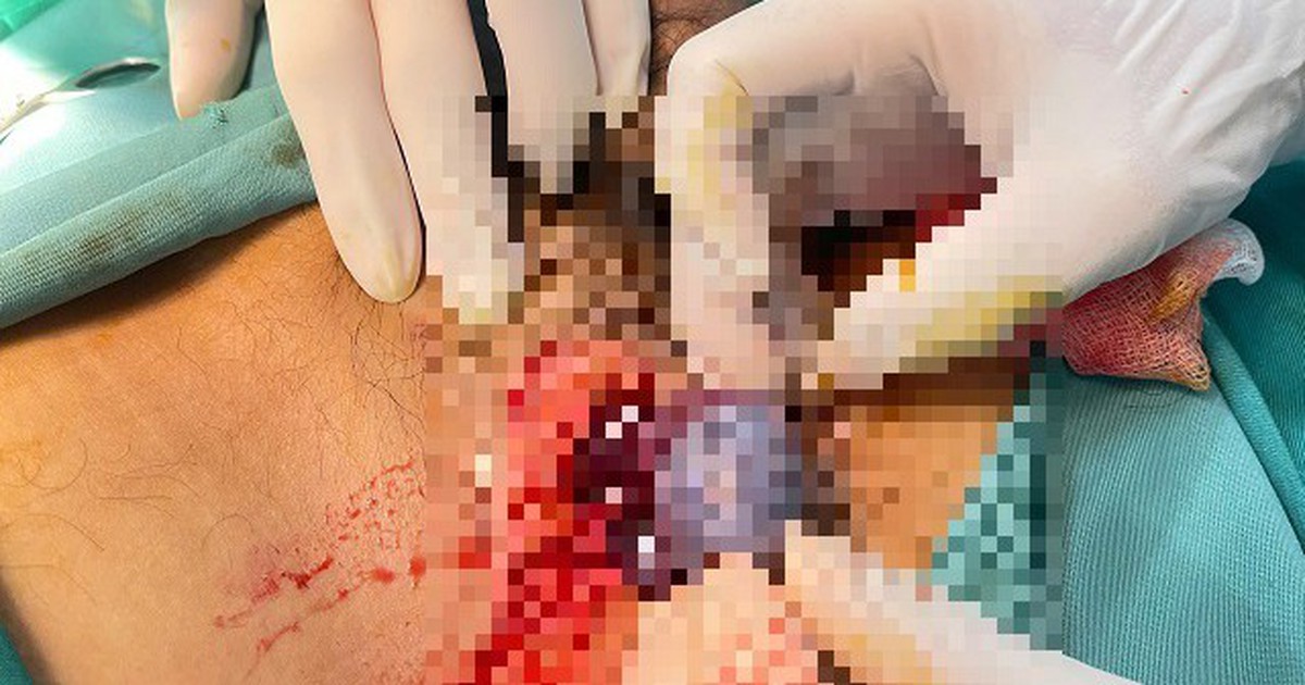 Nam giới đau vùng bẹn, cảnh giác dấu hiệu bệnh nguy hiểm