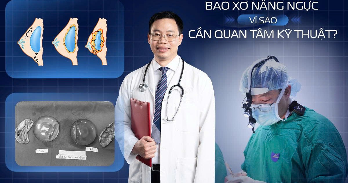 Bao xơ sau nâng ngực: Vì sao cần quan tâm đến kỹ thuật phẫu thuật?