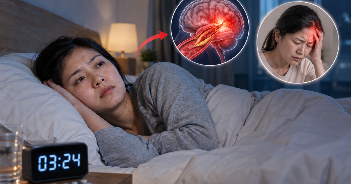 Mất ngủ kéo dài liên quan đến nguy cơ đột quỵ và sức khỏe não bộ
