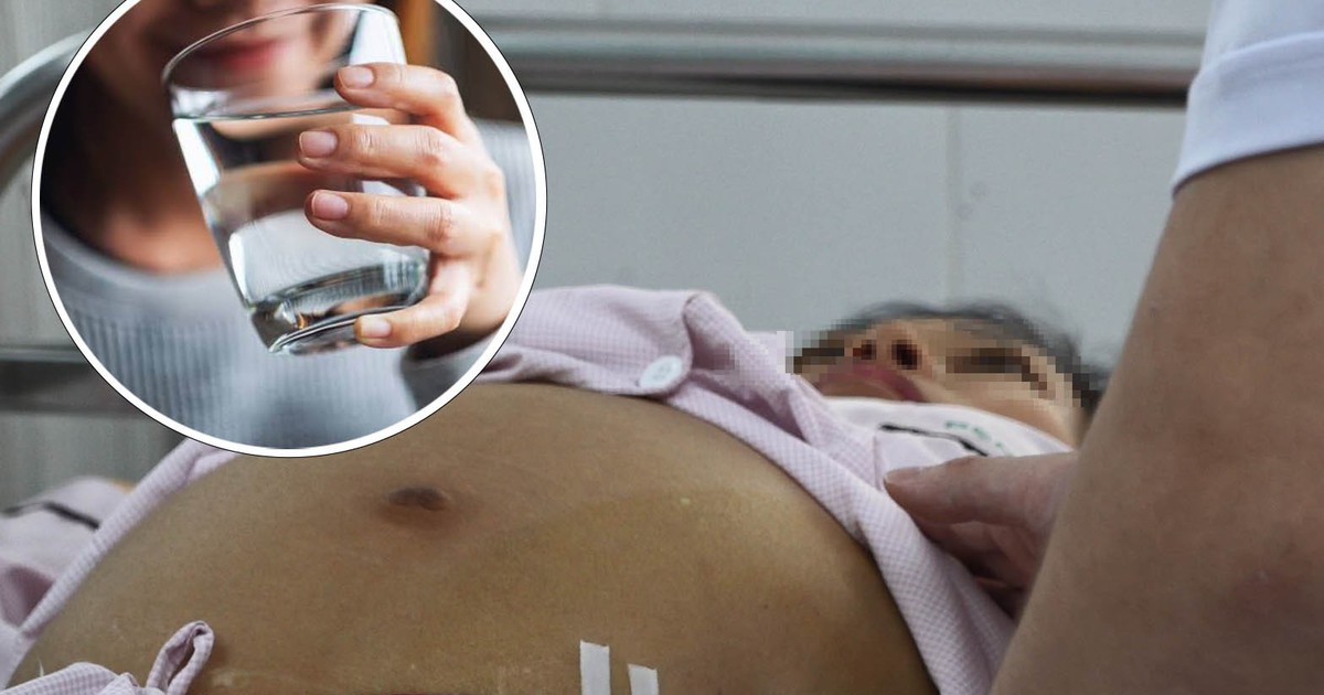 Uống 6 lít nước mỗi ngày làm đẹp da, người phụ nữ co giật rồi hôn mê