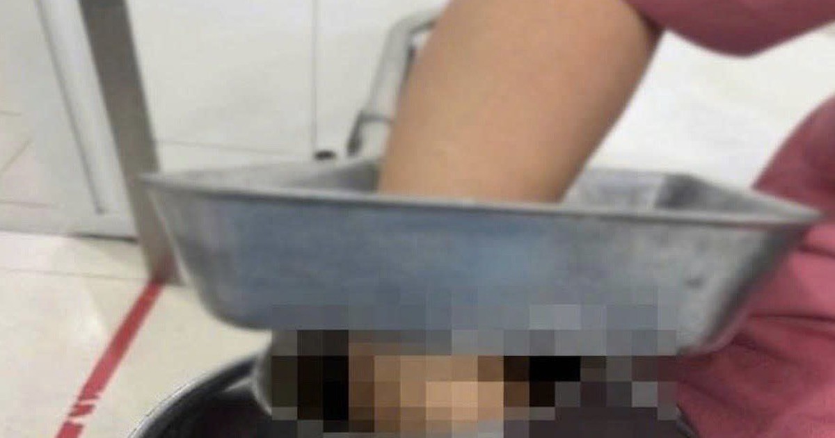 Nữ nhân viên nấu ăn ở trường học bị bàn tay phải cuốn vào máy xay thịt