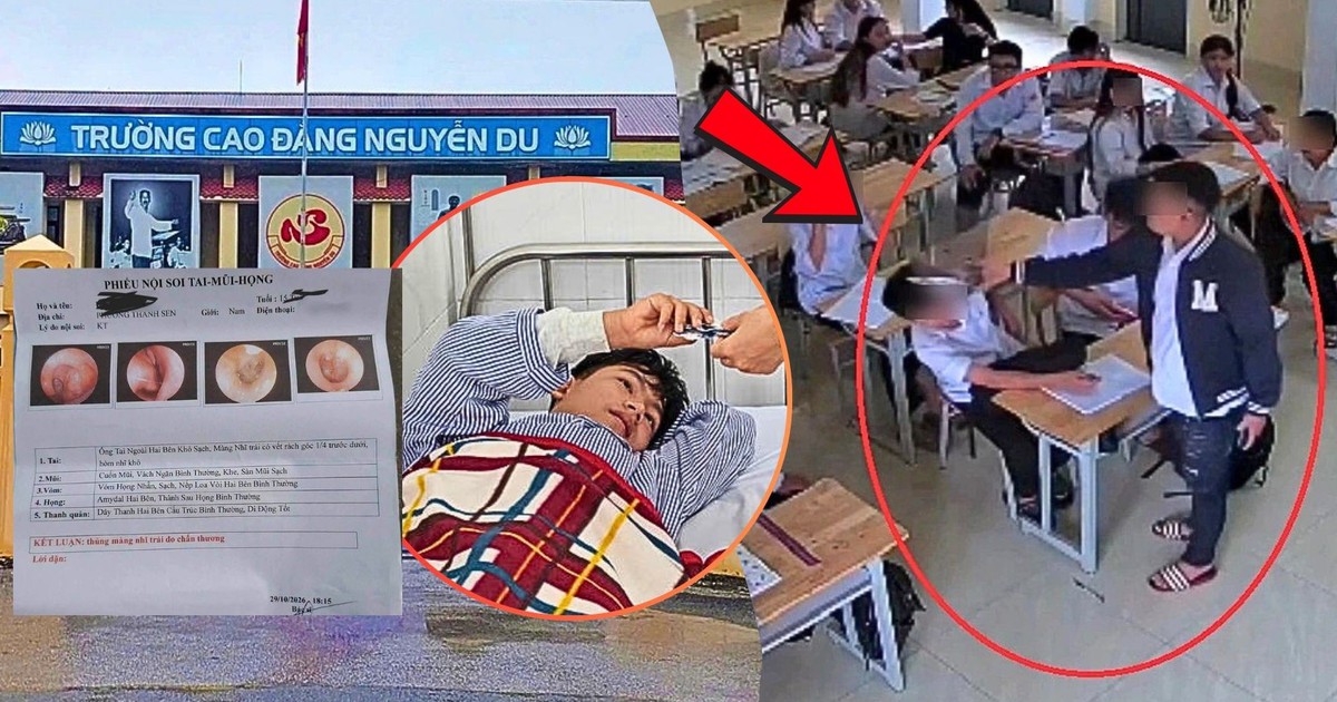 Nam sinh lớp 10 kể lại phút bị bạn tát liên tiếp, dẫn đến thủng màng nhĩ