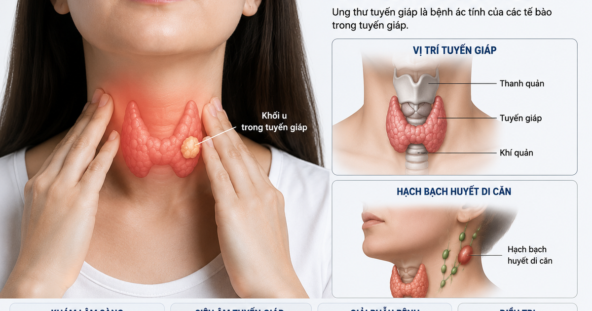 Sau mổ ung thư tuyến giáp, ai cần điều trị I-131?