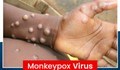 Giới y tế thế giới lo ngại bùng phát dịch bệnh đậu mùa khỉ sau hơn 40 năm kết thúc tiêm phòng
