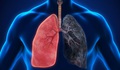 C&#225;c t&#225;c dụng phụ thường gặp khi điều trị ung thư phổi