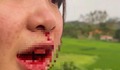 Đang xác minh vụ tài xế ô tô hành hung cô gái chảy máu mũi ở Bắc Giang