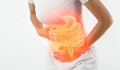 Polyp đại tràng có nguy hiểm không?