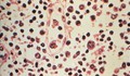 Tỷ lệ tử vong do nhiễm virus Hanta tăng cao, Chile nâng mức cảnh báo y tế