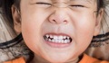 Răng cửa ngả vàng ở trẻ có ảnh hưởng gì đến sức khỏe?