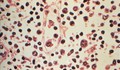 Đài Loan (Trung Quốc) ghi nhận 1 ca tử vong do nhiễm virus Hanta