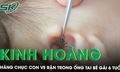 Kinh ho&#224;ng h&#224;ng chục con ve rận trong ống tai b&#233; g&#225;i 6 tuổi