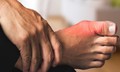 8 b&#237; quyết đơn giản để ph&#242;ng ngừa bệnh gout