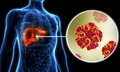 Sống khỏe với HIV v&#224; vi&#234;m gan C - tương lai đầy hy vọng cho người đồng nhiễm