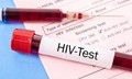 Thực trạng HIV/AIDS ở Việt Nam: Dịch đã được kiểm soát nhưng chưa thể chủ quan