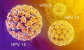 Chủng virus HPV n&#224;o dễ g&#226;y ung thư cổ tử cung nhất?