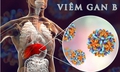 Bỏ điều trị viêm gan B mạn tính, người đàn ông nguy kịch phải ghép gan cấp cứu