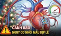 Nguy cơ nhồi máu cơ tim dịp lễ, cuối năm tăng mạnh