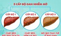 Hai cách đơn giản giúp bảo vệ gan khỏe mạnh mỗi ngày