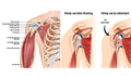 Một số thuốc d&#249;ng trị vi&#234;m quanh khớp vai