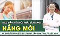 Đau đầu mệt mỏi khi nắng mới, phải l&#224;m sao?